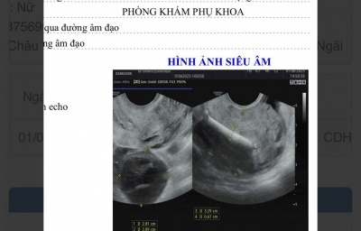 BVSN Quét mã QR để kiểm tra/nhận kết quả khám bệnh.